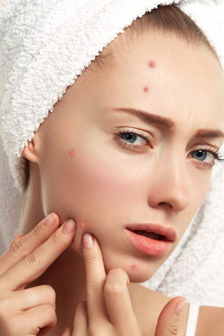 Facial para Acné